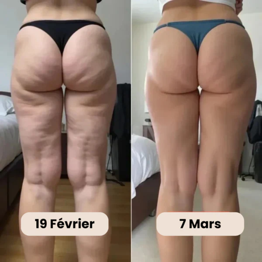 Culotte 3D Anti-Cellulite