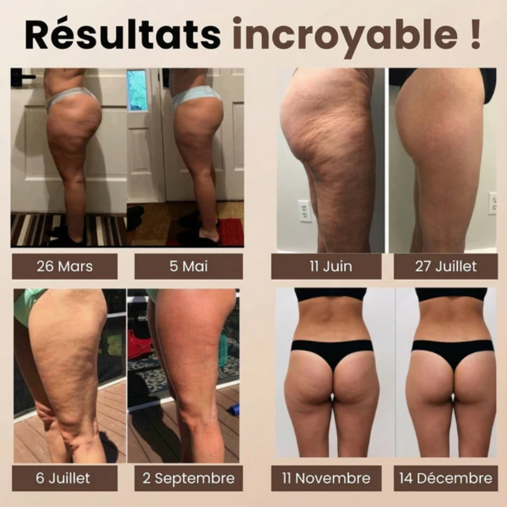 Culotte 3D Anti-Cellulite