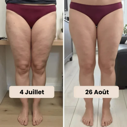 Culotte 3D Anti-Cellulite